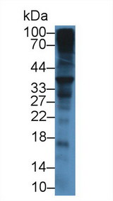 SDC1 / Syndecan 1 / CD138 Antibody - Western Blot; Sample: Mouse Liver lysate; Primary Ab: 12µg/mL Rabbit Anti-Mouse SDC1 Antibody Second Ab: 0.2µg/mL HRP-Linked Caprine Anti-Rabbit IgG Polyclonal Antibody