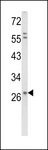 SDC1 / Syndecan 1 / CD138 Antibody - Western blot of CD138 Antibody (C-term K281) in HepG2 cell line lysates (35 ug/lane). CD138 (arrow) was detected using the purified antibody.