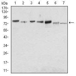 SDC1 / Syndecan 1 / CD138 Antibody - Western blot using SDC1 mouse monoclonal antibody against MCF-7 (1), HeLa (2), HepG2 (3), T47D (4), SW620 (5), Jurkat (6) and NIH/3T3 (7) cell lysate.