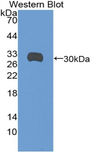 SDC1 / Syndecan 1 / CD138 Antibody - Western blot of recombinant SDC1 / Syndecan 1 / CD138.