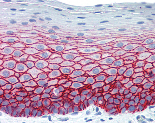 SDC1 / Syndecan 1 / CD138 Antibody - Anti-SDC1 / Syndecan 1 / CD138 antibody IHC staining of human tonsil, squamous epithelium. Immunohistochemistry of formalin-fixed, paraffin-embedded tissue after heat-induced antigen retrieval.  This image was taken for the unconjugated form of this product. Other forms have not been tested.