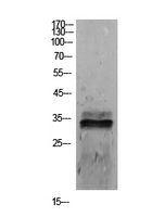 SDC1 / Syndecan 1 / CD138 Antibody - Western Blot analysis of extracts from 293 cells using SDC1 Antibody.