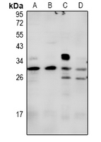 SDC2 / Syndecan 2 Antibody - Western blot analysis of Syndecan 2 expression in COS7 (A), MCF7 (B), CT26 (C), PC12 (D) whole cell lysates.