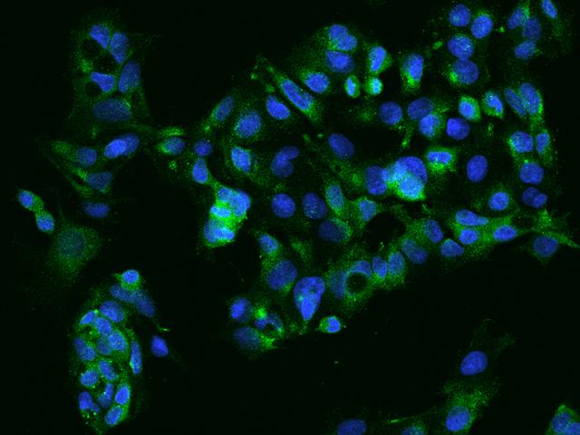 SDC2 / Syndecan 2 Antibody - Immunofluorescence staining of SDC2 in HepG2 cells. Cells were fixed with 4% PFA, blocked with 10% serum, and incubated with rabbit anti-Human SDC2 polyclonal antibody (dilution ratio 1:200) at 4°C overnight. Then cells were stained with the Alexa Fluor 488-conjugated Goat Anti-rabbit IgG secondary antibody (green) and counterstained with DAPI (blue). Positive staining was localized to Cytoplasm.