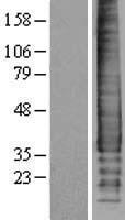 SDC2 / Syndecan 2 Protein - Western validation with an anti-DDK antibody * L: Control HEK293 lysate R: Over-expression lysate