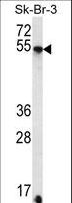 SDC3 / Syndecan 3 Antibody - SDC3 Antibody western blot of SK-BR-3 cell line lysates (35 ug/lane). The SDC3 antibody detected the SDC3 protein (arrow).