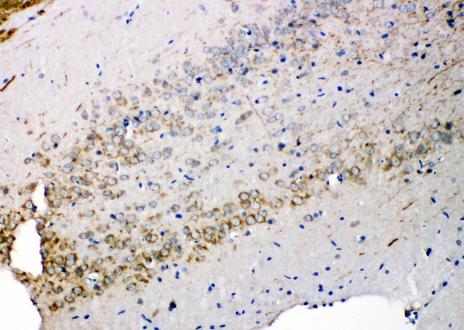 SDC3 / Syndecan 3 Antibody - SDC3 / Syndecan 3 antibody. IHC(P): Rat Brain Tissue.