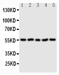SDC3 / Syndecan 3 Antibody - Anti-Syndecan 3/SDC3 antibody, Western blotting Lane 1: U87 Cell LysateLane 2: 293T Cell LysateLane 3: PC-12 Cell LysateLane 4: NRK Cell LysateLane 5: HT1080 Cell Lysate