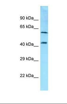 SDC3 / Syndecan 3 Antibody - Western blot of Human NCI-H226 . SDC3 antibody dilution 1.0 ug/ml.  This image was taken for the unconjugated form of this product. Other forms have not been tested.