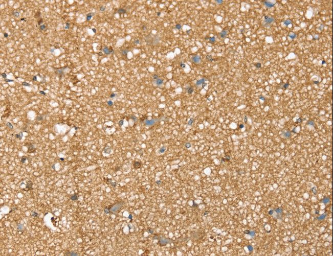 SDC3 / Syndecan 3 Antibody - Immunohistochemistry of paraffin-embedded Human brain using SDC3 Polyclonal Antibody at dilution of 1:45.