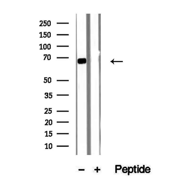 SDC3 / Syndecan 3 Antibody - Western blot analysis of extracts of A549 cells using Syndecan-3 antibody.