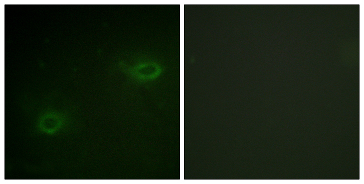 SDC4 / Syndecan 4 Antibody - Immunofluorescence analysis of HeLa cells, using Syndecan4 Antibody. The picture on the right is blocked with the synthesized peptide.