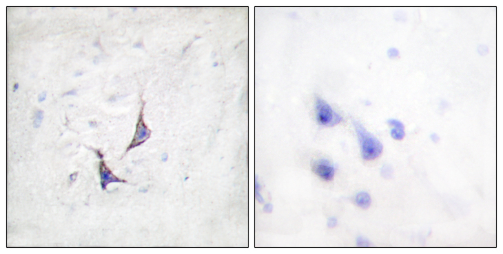 SDC4 / Syndecan 4 Antibody - Immunohistochemistry analysis of paraffin-embedded human brain tissue, using Syndecan4 Antibody. The picture on the right is blocked with the synthesized peptide.