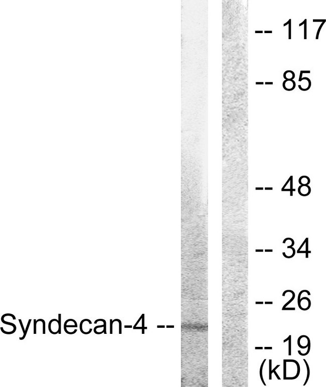SDC4 / Syndecan 4 Antibody - Western blot analysis of lysates from HepG2 cells, using Syndecan4 Antibody. The lane on the right is blocked with the synthesized peptide.