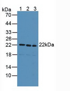 SDC4 / Syndecan 4 Antibody - Western Blot; Sample: Lane1: Human Liver Tissue; Lane2: Human 293T Cells; Lane3: Mouse Kidney Tissue.