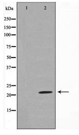 SDC4 / Syndecan 4 Antibody - Western blot of HepG2 cell lysate using Syndecan4 Antibody