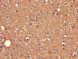 SDC4 / Syndecan 4 Antibody - Immunohistochemistry of paraffin-embedded human brain tissue at dilution of 1:100