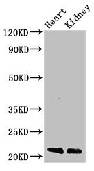 SDC4 / Syndecan 4 Antibody - Western Blot Positive WB detected in:Mouse heart tissue,Mouse kidney tissue All Lanes:SDC4 antibody at 3µg/ml Secondary Goat polyclonal to rabbit IgG at 1/50000 dilution Predicted band size: 22,17 KDa Observed band size: 22 KDa