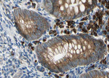 SDC4 / Syndecan 4 Antibody - 1:100 staining human appendix tissue by IHC-P. The tissue was formaldehyde fixed and a heat mediated antigen retrieval step in citrate buffer was performed. The tissue was then blocked and incubated with the antibody for 1.5 hours at 22°C. An HRP conjugated goat anti-rabbit antibody was used as the secondary.