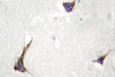 SDC4 / Syndecan 4 Antibody - IHC of Syndecan-4 (K175) pAb in paraffin-embedded human brain tissue.