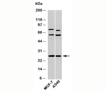 SDC4 / Syndecan 4 Antibody - Syndecan 4 antibody western blot of human samples
