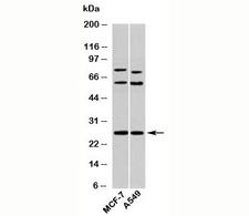 SDC4 / Syndecan 4 Antibody - Syndecan 4 antibody western blot of human samples