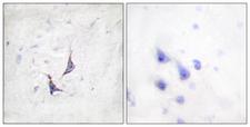 SDC4 / Syndecan 4 Antibody - Peptide - + Immunohistochemistry analysis of paraffin-embedded human brain tissue using Syndecan4 (Ab-179) antibody.