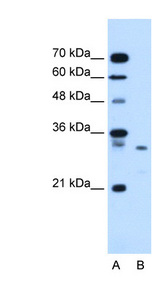 SDCBP / Syntenin Antibody - SDCBP / Syntenin antibody ARP44535_T100-NP_001007068-SDCBP(syndecan binding protein (syntenin)) Antibody Western blot of HepG2 cell lysate.  This image was taken for the unconjugated form of this product. Other forms have not been tested.