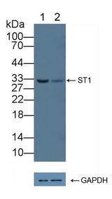 SDCBP / Syntenin Antibody - Knockout Varification: Lane 1: Wild-type Hela cell lysate; Lane 2: ST1 knockout Hela cell lysate; Predicted MW: 32kd Observed MW: 32kd Primary Ab: 1µg/ml Rabbit Anti-Human ST1 Antibody Second Ab: 0.2µg/mL HRP-Linked Caprine Anti-Rabbit IgG Polyclonal Antibody