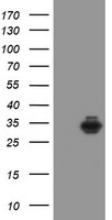 SDCBP / Syntenin Antibody - HEK293T cells were transfected with the pCMV6-ENTRY control (Left lane) or pCMV6-ENTRY SDCBP (Right lane) cDNA for 48 hrs and lysed. Equivalent amounts of cell lysates (5 ug per lane) were separated by SDS-PAGE and immunoblotted with anti-SDCBP.