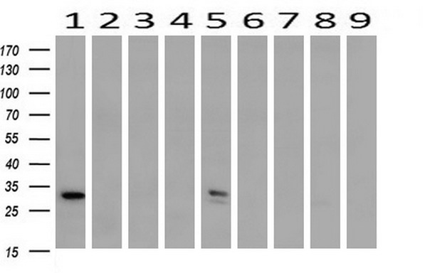 SDCBP / Syntenin Antibody - Western blot of extracts (10ug) from 9 Human tissue by using anti-SDCBP monoclonal antibody at 1:200 (1: Testis; 2: Omentum; 3: Uterus; 4: Breast; 5: Brain; 6: Liver; 7: Ovary; 8: Thyroid gland; 9: Colon).