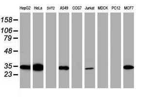 SDCBP / Syntenin Antibody - Western blot of extracts (35ug) from 9 different cell lines by using anti-SDCBP monoclonal antibody (HepG2: human; HeLa: human; SVT2: mouse; A549: human; COS7: monkey; Jurkat: human; MDCK: canine; PC12: rat; MCF7: human).