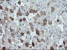 SDCBP / Syntenin Antibody - IHC of paraffin-embedded Human liver tissue using anti-SDCBP mouse monoclonal antibody. (Heat-induced epitope retrieval by 10mM citric buffer, pH6.0, 100C for 10min).