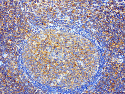 SDCBP / Syntenin Antibody - Immunohistochemical staining of paraffin-embedded tonsil using anti-SDCBP clone UMAB69 mouse monoclonal antibody  at 1:100 with Polink2 Broad HRP DAB detection kit; heat-induced epitope retrieval with GBI Citrate pH6.0 HIER buffer using pressure chamber for 3 minutes at 110C. Membrane and cytoplasmic staining is seen in germinal and non germinal center of the the tonsil .