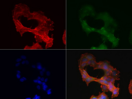 SDCBP / Syntenin Antibody - Immunofluorescent staining of MCF-7 cells using anti-SDCBP mouse monoclonal antibody  green, 1:50). Actin filaments were labeled with TRITC-phalloidin. (red), and nuclear with DAPI. (blue).