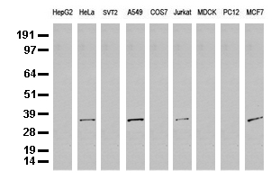 SDCBP / Syntenin Antibody - Western blot analysis of extracts. (35ug) from 9 different cell lines by using anti-SDCBP monoclonal antibody. (Clone UMAB69).