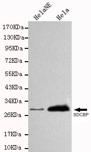 SDCBP / Syntenin Antibody - Western blot detection of SDCBP in HeLa NE&HeLa cell lysates using SDCBP antibody (1:1000 diluted).