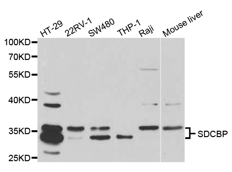 SDCBP / Syntenin Antibody - Western blot analysis of extracts of various cell lines.