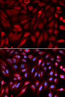 SDCBP / Syntenin Antibody - Immunofluorescence analysis of U2OS cells.