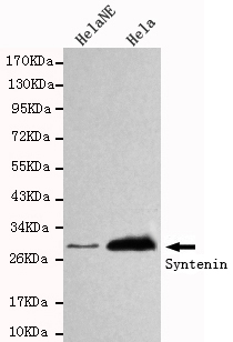 SDCBP / Syntenin Antibody - Western blot detection of Syntenin in HeLa NE and HeLa cell lysates using Syntenin mouse monoclonal antibody (1:1000 dilution). Predicted band size: 32KDa. Observed band size:32KDa.
