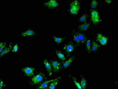 SDCBP / Syntenin Antibody - Immunofluorescent analysis of HepG2 cells using SDCBP Antibody at dilution of 1:100 and Alexa Fluor 488-congugated AffiniPure Goat Anti-Rabbit IgG(H+L)