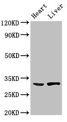 SDCBP / Syntenin Antibody - Western Blot Positive WB detected in: Mouse heart tissue, Rat liver tissue All lanes: SDCBP antibody at 3µg/ml Secondary Goat polyclonal to rabbit IgG at 1/50000 dilution Predicted band size: 33, 32 kDa Observed band size: 33 kDa