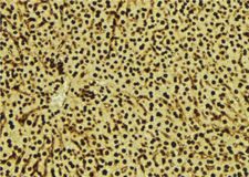 SDCBP / Syntenin Antibody - 1:100 staining mouse liver tissue by IHC-P. The sample was formaldehyde fixed and a heat mediated antigen retrieval step in citrate buffer was performed. The sample was then blocked and incubated with the antibody for 1.5 hours at 22°C. An HRP conjugated goat anti-rabbit antibody was used as the secondary.
