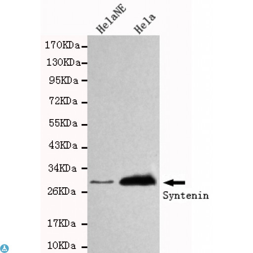 SDCBP / Syntenin Antibody - Western blot detection of Syntenin in HelaNE and Hela cell lysates using Syntenin mouse mAb (1:1000 diluted). Predicted band size: 32KDa. Observed band size: 32KDa.