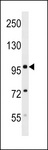SDCCAG1 / NEMF Antibody - Mouse Sdccag1 Antibody western blot of mouse kidney tissue lysates (35 ug/lane). The Sdccag1 antibody detected the Sdccag1 protein (arrow).