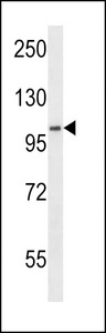 SDCCAG1 / NEMF Antibody - SDCCAG1 Antibody western blot of WiDr cell line lysates (35 ug/lane). The SDCCAG1 antibody detected the SDCCAG1 protein (arrow).