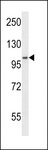SDCCAG1 / NEMF Antibody - SDCCAG1 Antibody western blot of WiDr cell line lysates (35 ug/lane). The SDCCAG1 antibody detected the SDCCAG1 protein (arrow).