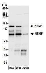 SDCCAG1 / NEMF Antibody - Detection of human NEMF by western blot. Samples: Whole cell lysate (15 µg) from HeLa, HEK293T, and Jurkat cells prepared using NETN lysis buffer. Antibody: Affinity purified rabbit anti-NEMF antibody used for WB at 1:1000. Detection: Chemiluminescence with an exposure time of 10 seconds.