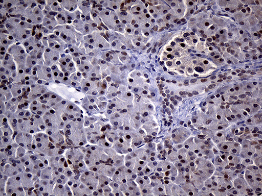 SDCCAG1 / NEMF Antibody - Immunohistochemical staining of paraffin-embedded Human pancreas tissue within the normal limits using anti-NEMF mouse monoclonal antibody. (Heat-induced epitope retrieval by 1mM EDTA in 10mM Tris buffer. (pH8.5) at 120°C for 3 min. (1:250)