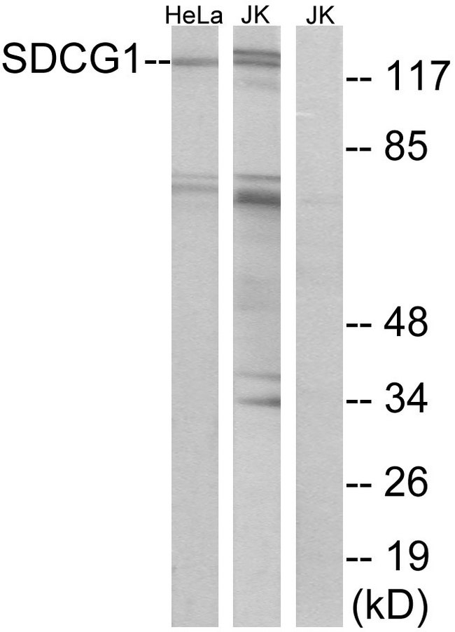 SDCCAG1 / NEMF Antibody - Western blot analysis of lysates from HeLa and Jurkat cells, using SDCG1 Antibody. The lane on the right is blocked with the synthesized peptide.
